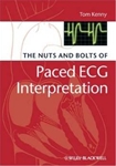 The Nuts and Bolts of Interpreting Paced ECGs and EGMs