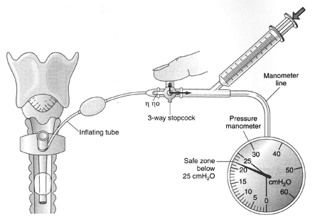 Thumbnail Tracheostomy Care